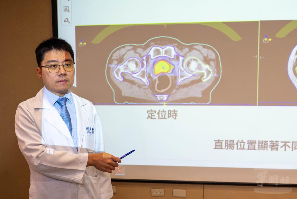 三總引進高階磁振刀　提高治療精準度與安全性